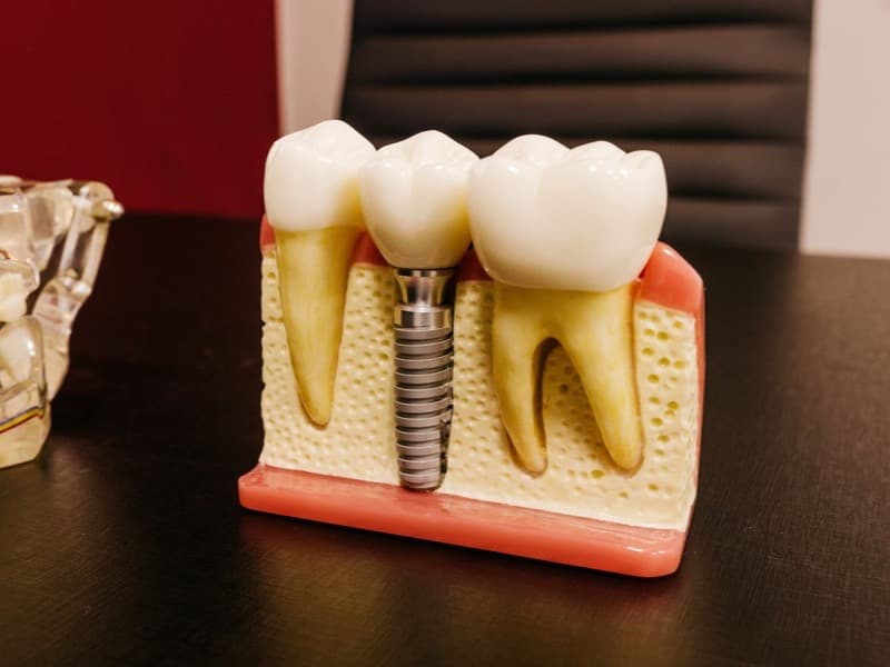 Implant Suite