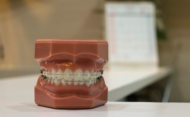 3D Dental Implants Treatment
