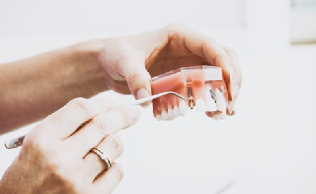 principle of digital smile designing