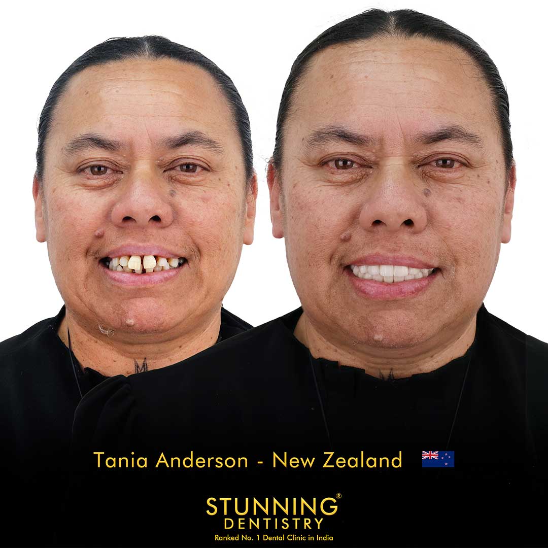 Teeth Specialist