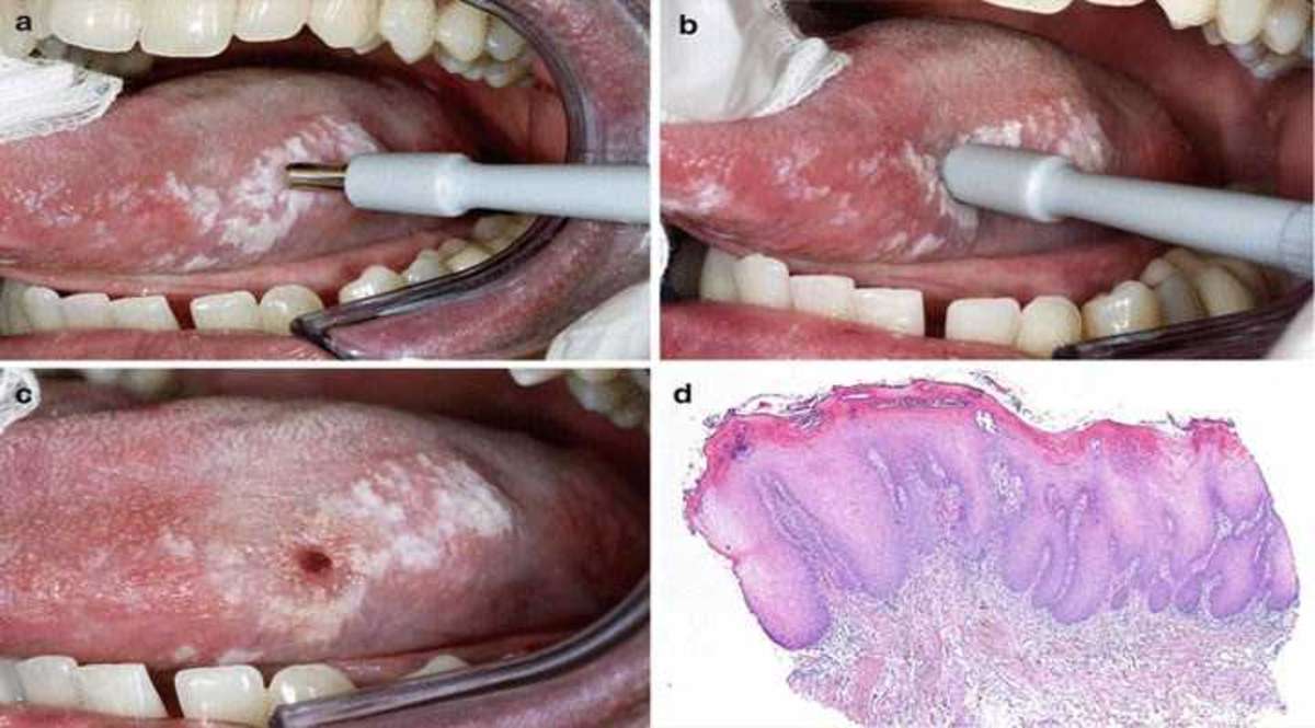 Procedure