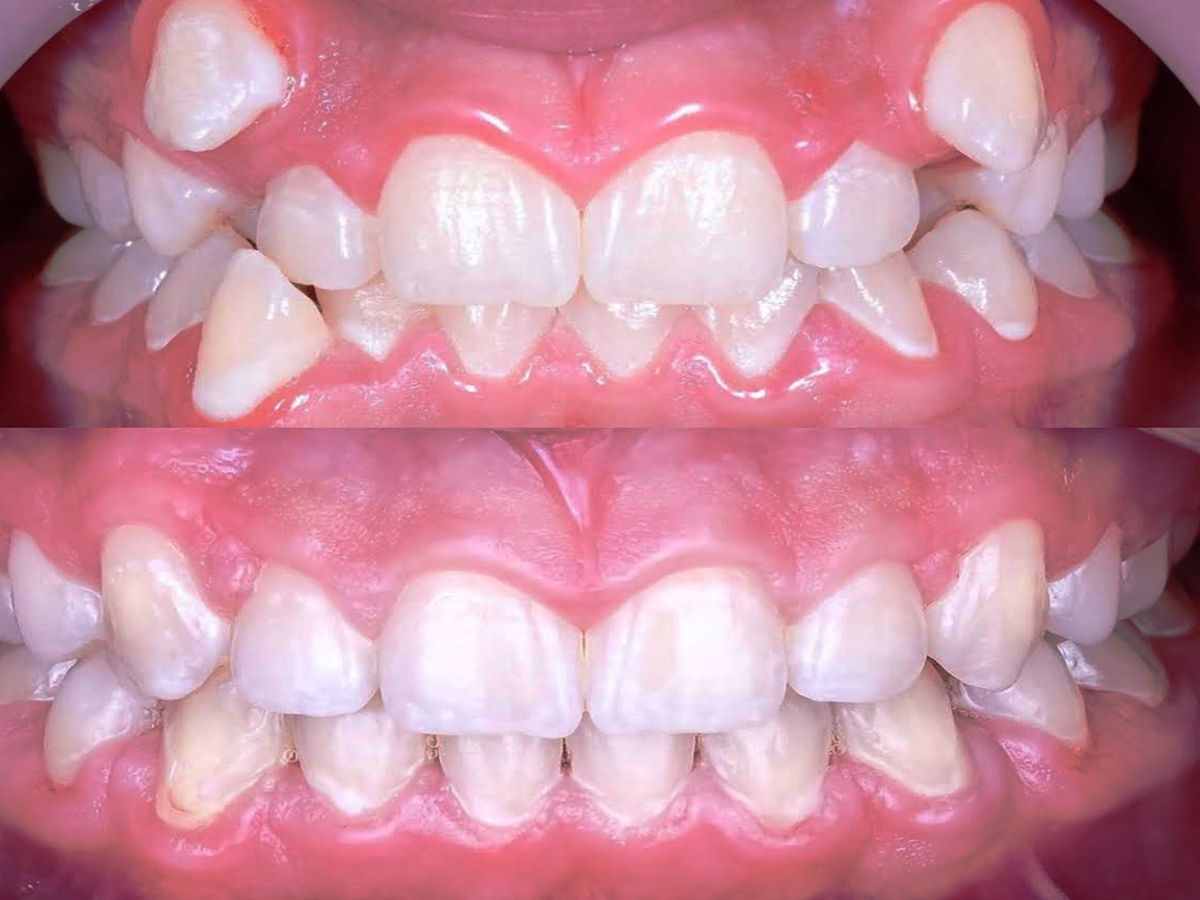 Orthodontics