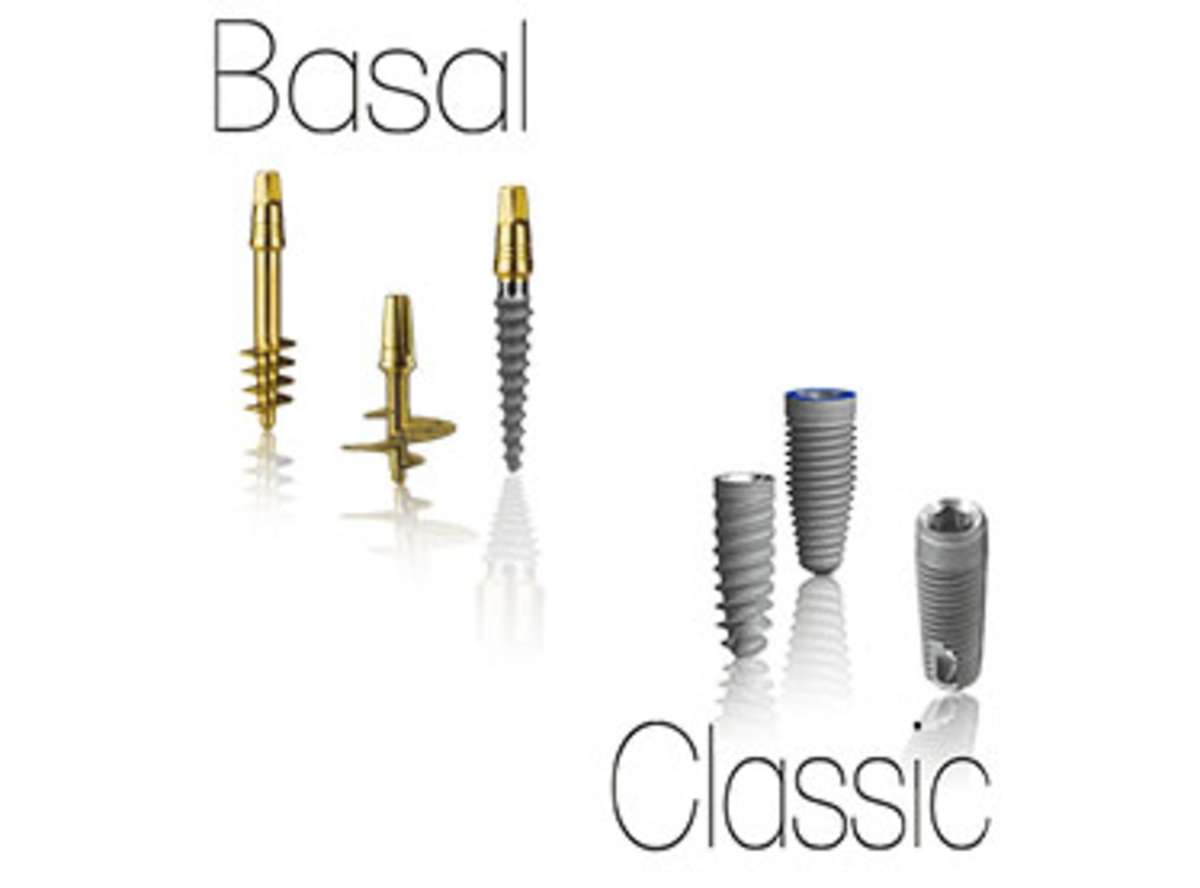 cost of Basal Implants in Paschim Vihar India