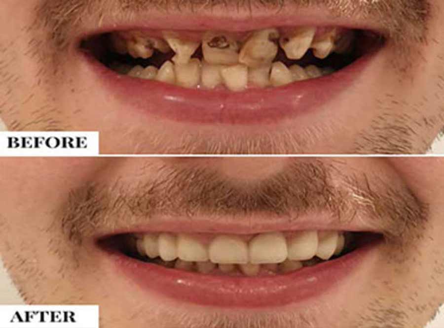 Same Day Dentistry packages