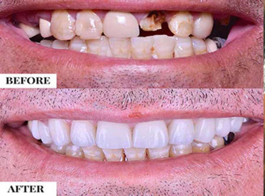 General Dentistry treatment packages