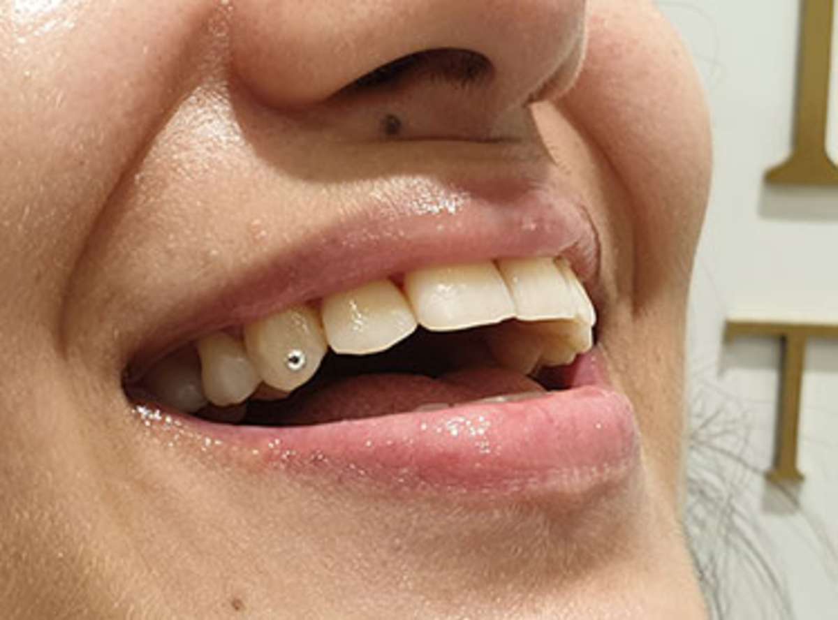 Tooth Jewellery in south delhi